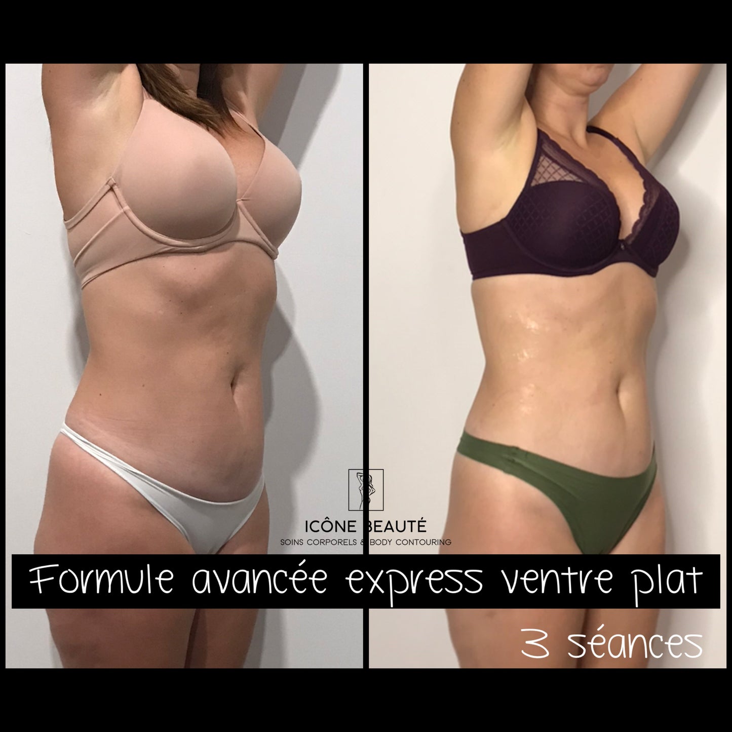 🔥 Forfait -  Combinaison Résultats Express – Abdominal 360°