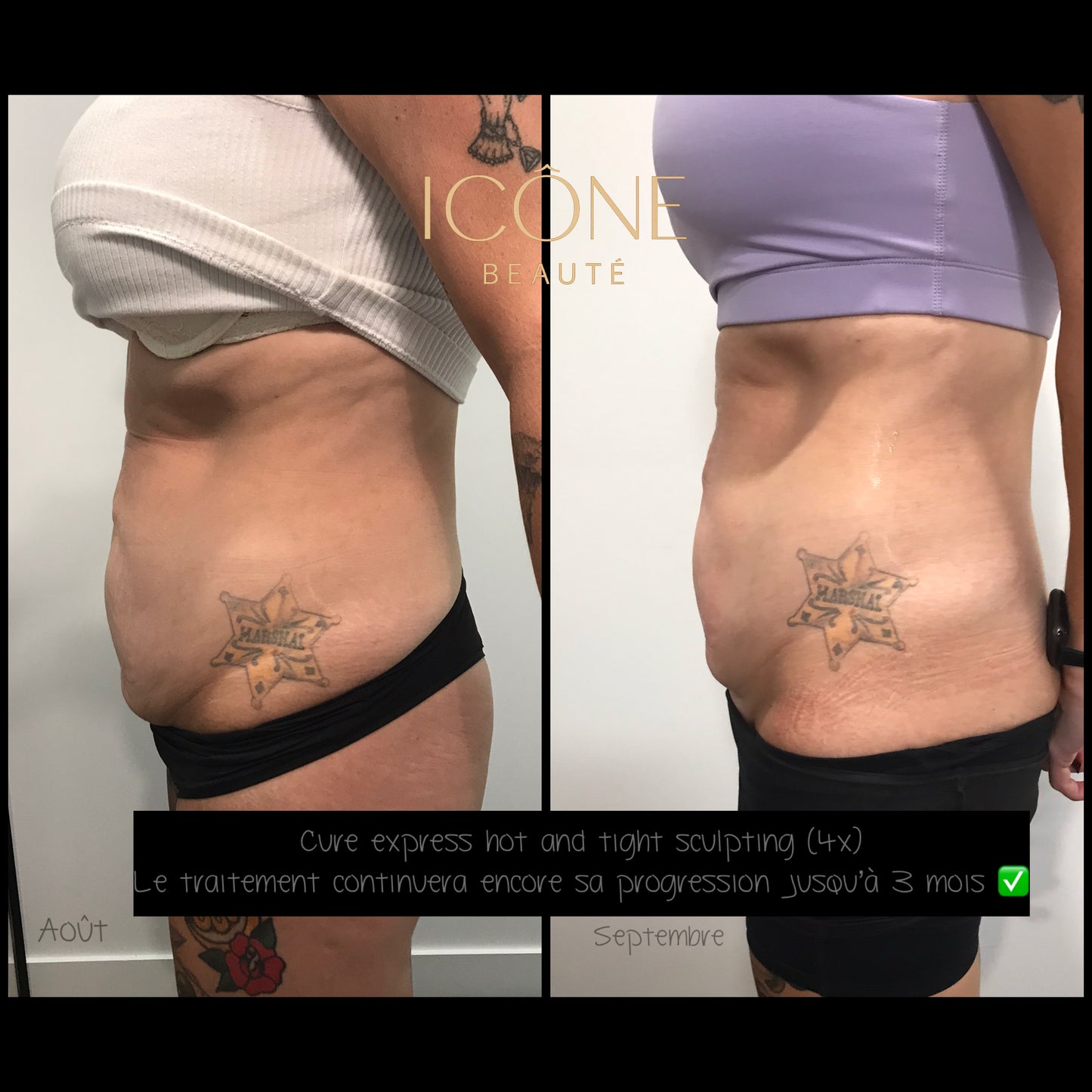 🔥 Cure 4 seances : Hot & Tight EXPRESS – Fonte Adipeuse & Skin Tightening Corps
