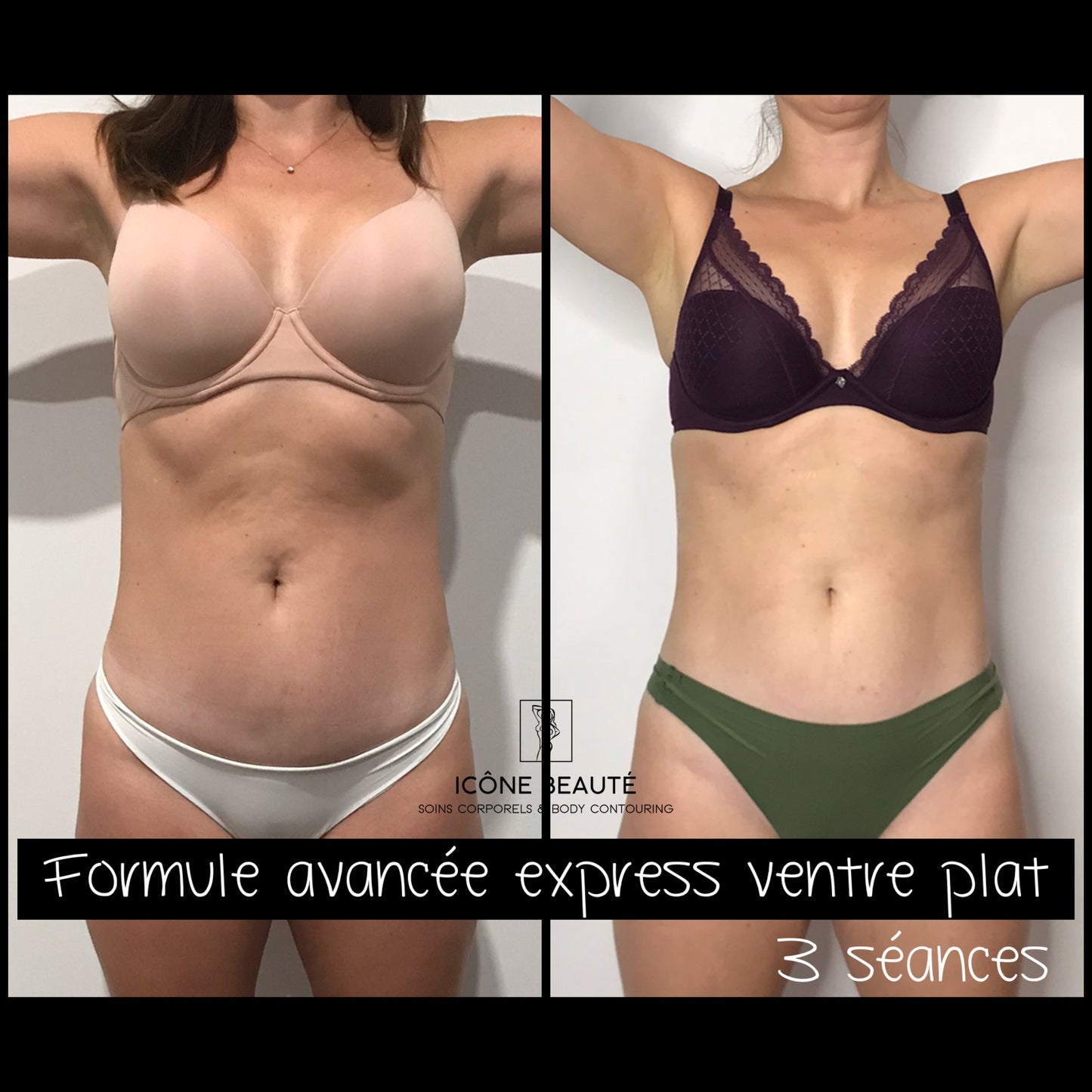 🔥 Forfait -  Combinaison Résultats Express – Abdominal 360°