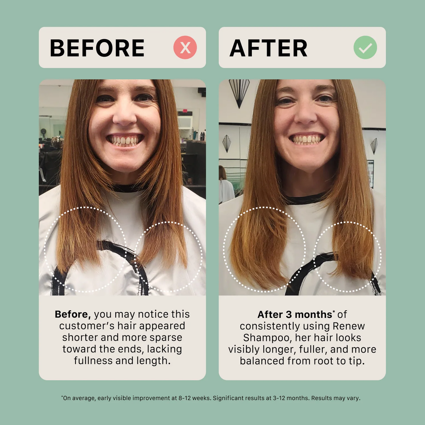 ACT•IV Renew Réparation Capillaire | Shampooing & Revitalisant
