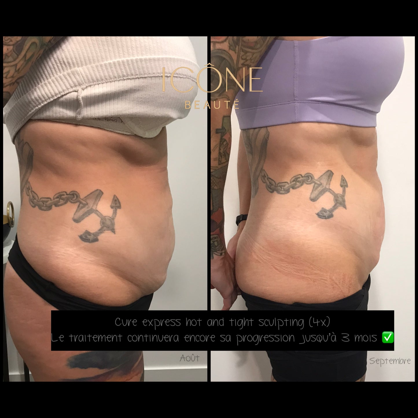 🔥 Cure 4 seances : Hot & Tight EXPRESS – Fonte Adipeuse & Skin Tightening Corps