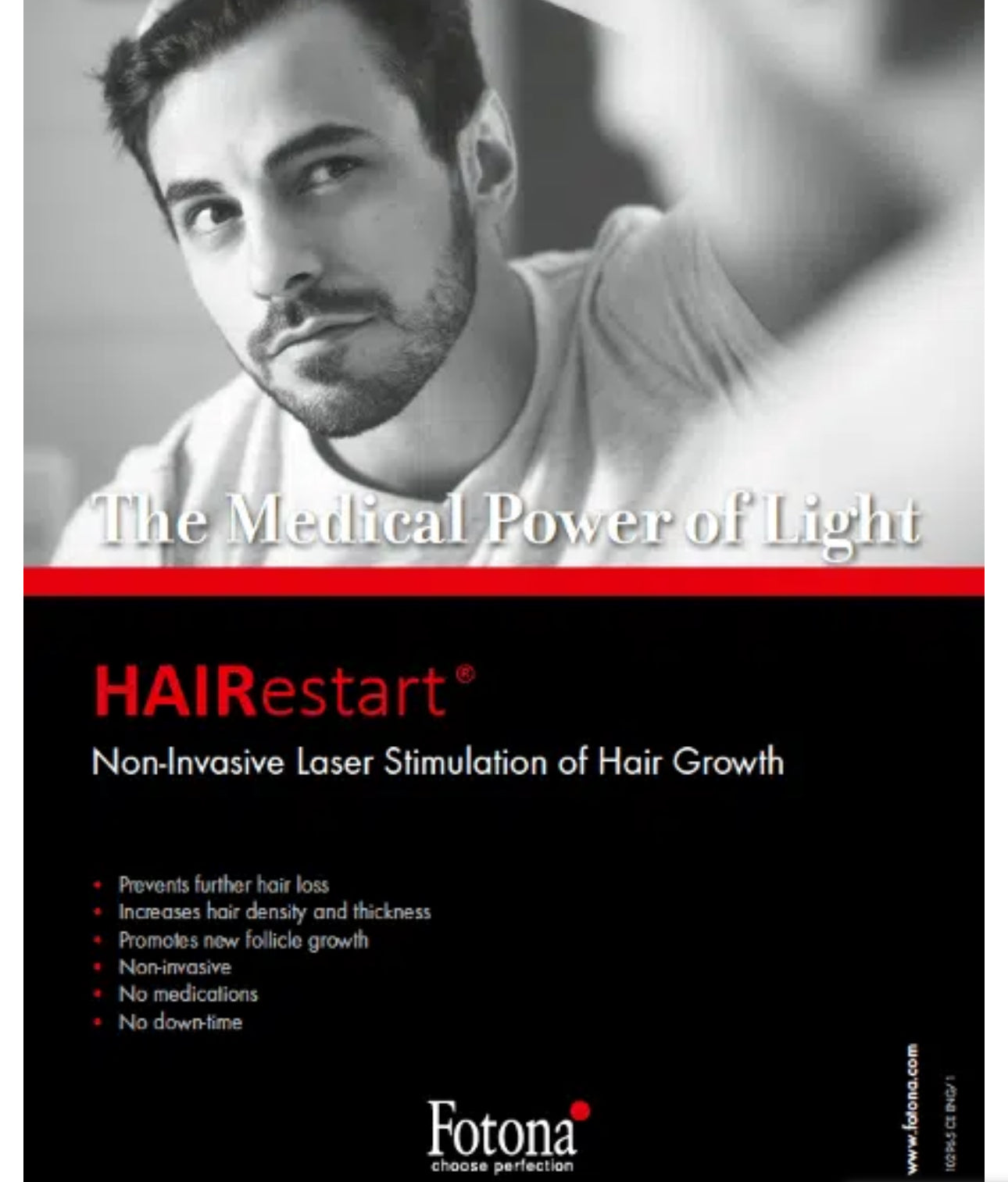 🔹 DENSIFICATION CAPILLAIRE - Laser Fotona - HairRestart®