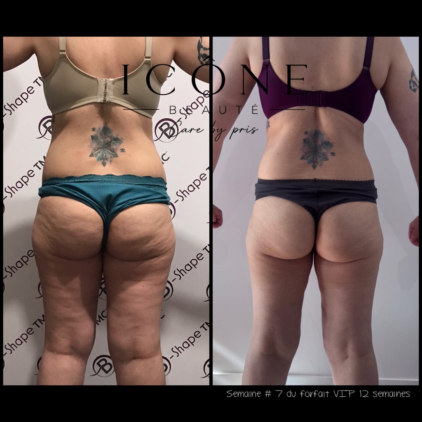 Forfait VIP 3 Mois Sculpt, Drain & Lift Illimité | Icône Beauté Québec