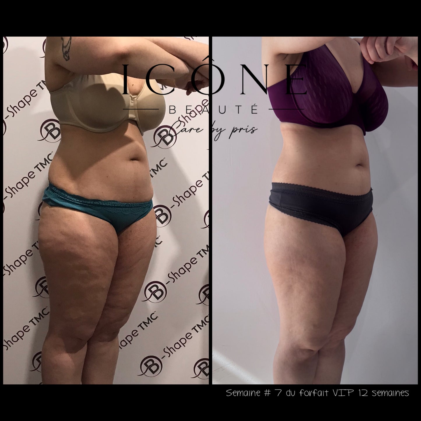 Forfait VIP 3 Mois Sculpt, Drain & Lift Illimité | Icône Beauté Québec