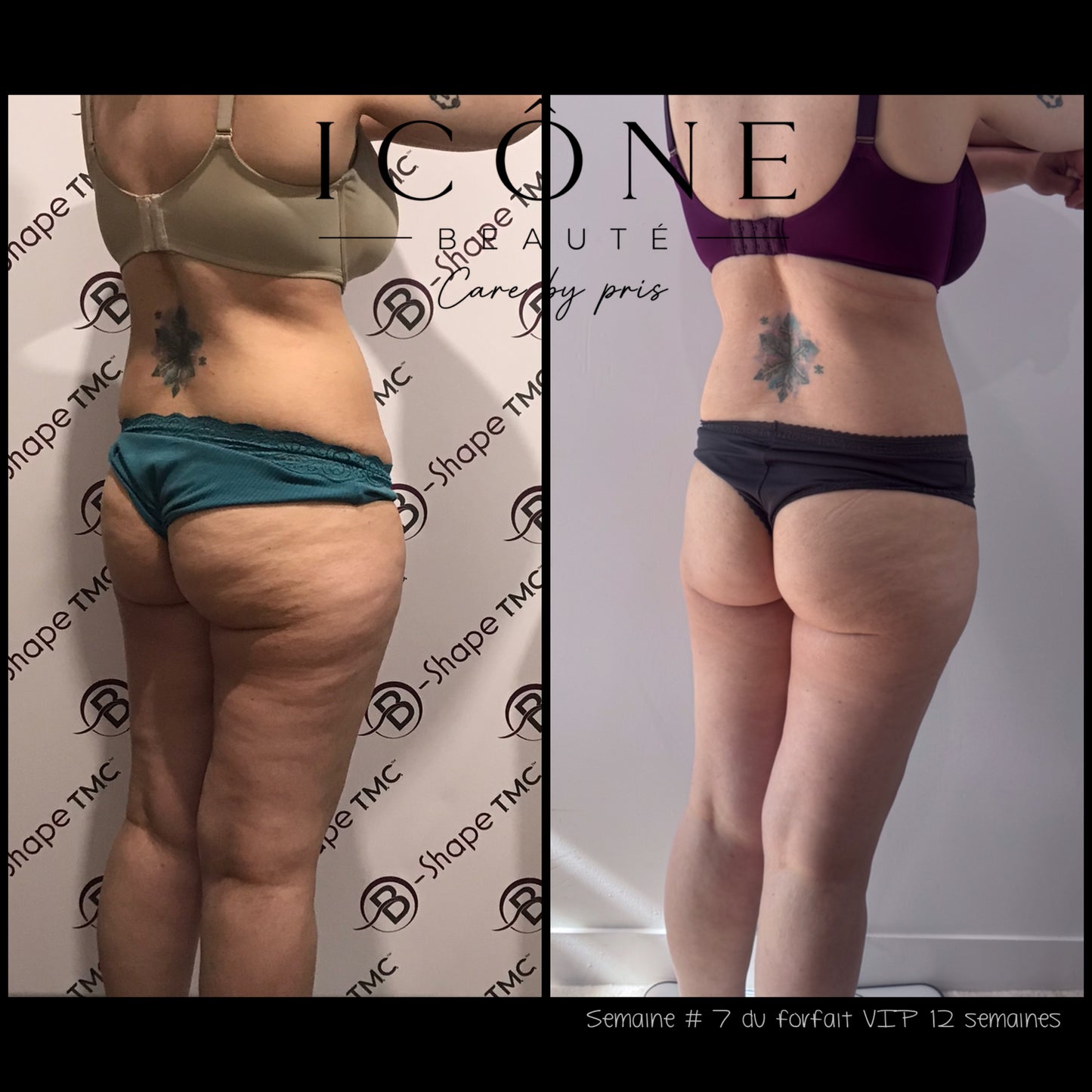 Forfait VIP 3 Mois Sculpt, Drain & Lift Illimité | Icône Beauté Québec
