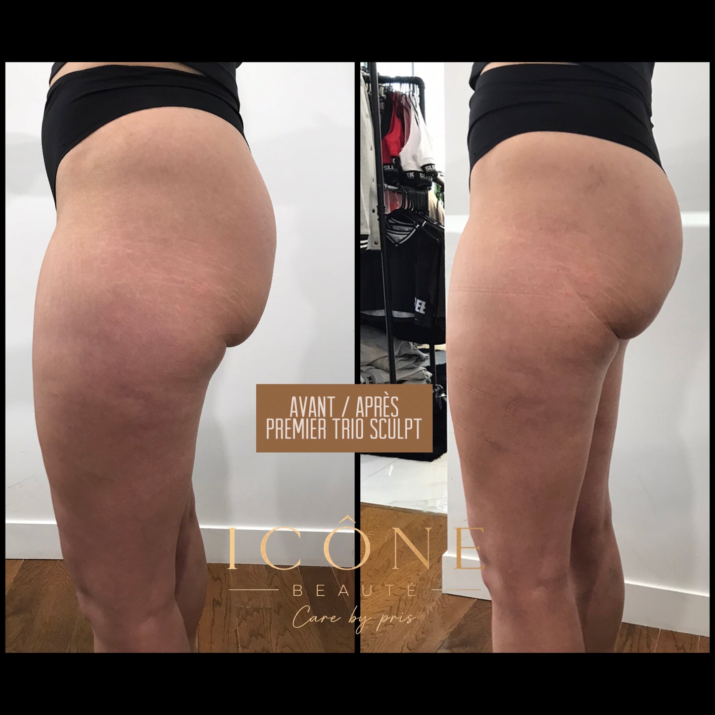 🧡  Trio Sculpt & Tight 3-en-1