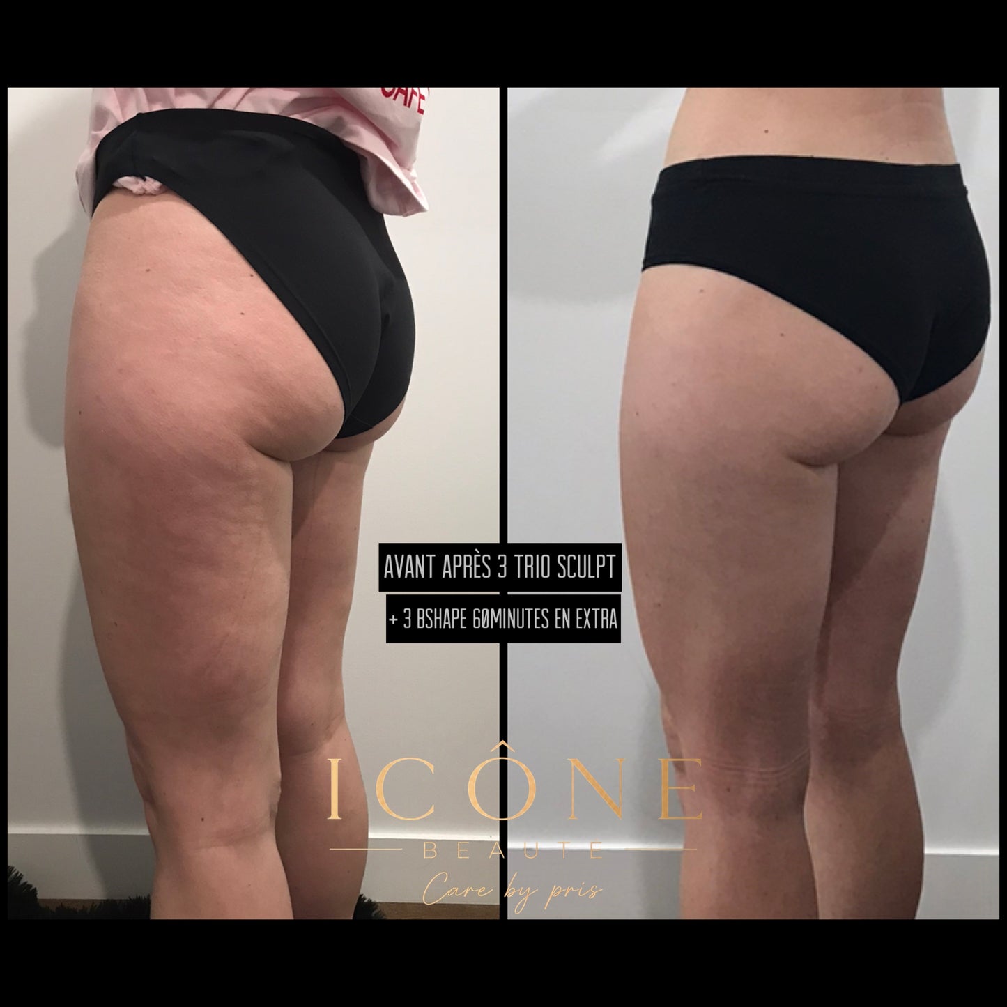 🧡  Trio Sculpt & Tight 3-en-1