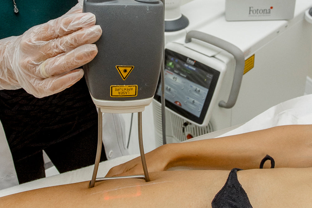 🔥 Hot & Tight Sculpting – Remodelage par Laser Fotona - CORPS