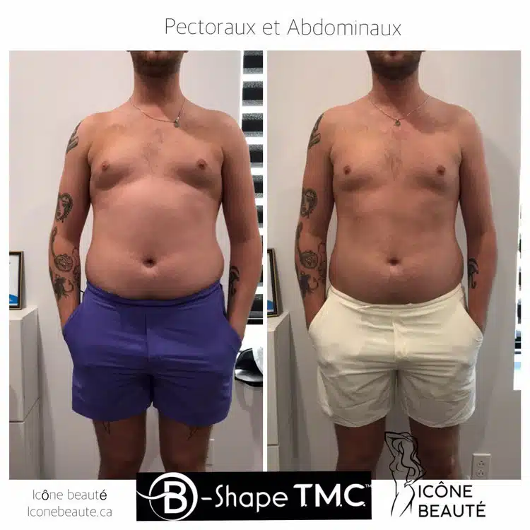 20220705_130615101_iOS