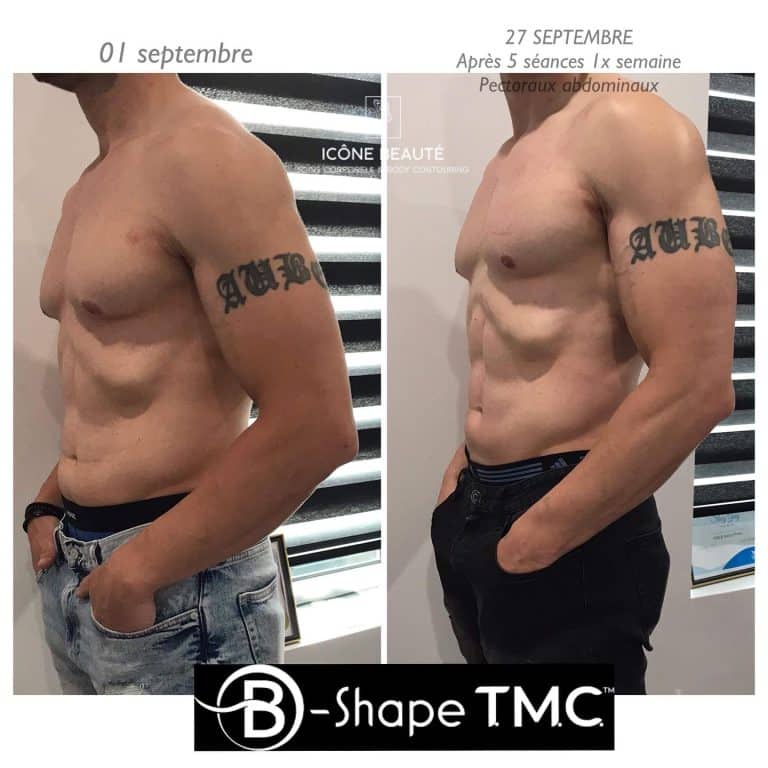 B Shape TMC - ICÔNE BEAUTÉ