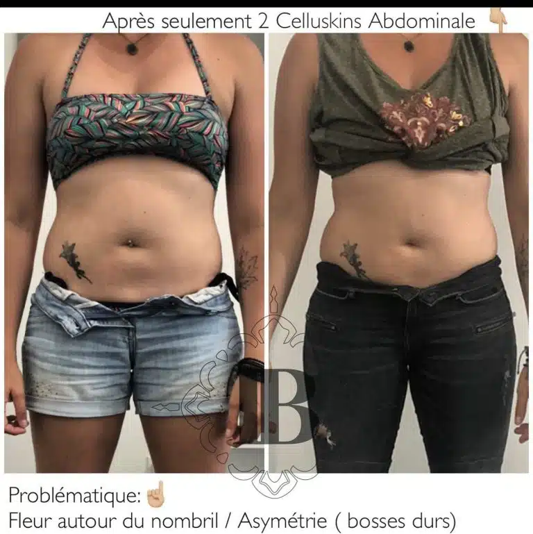 20221114_220810000_iOS