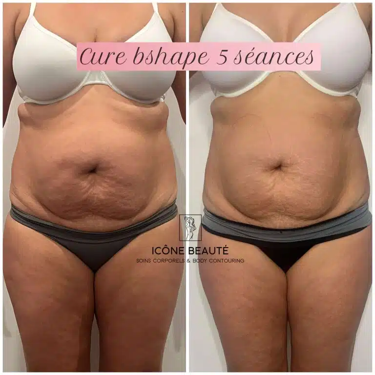 20221205_235952459_iOS