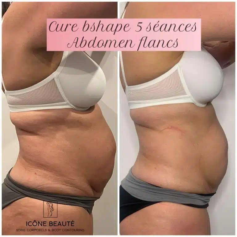 20221206_000307837_iOS