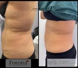 Hot & Tight Sculpting