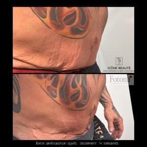 Hot & Tight Sculpting