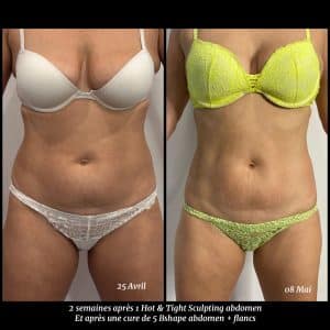 Hot & Tight Sculpting