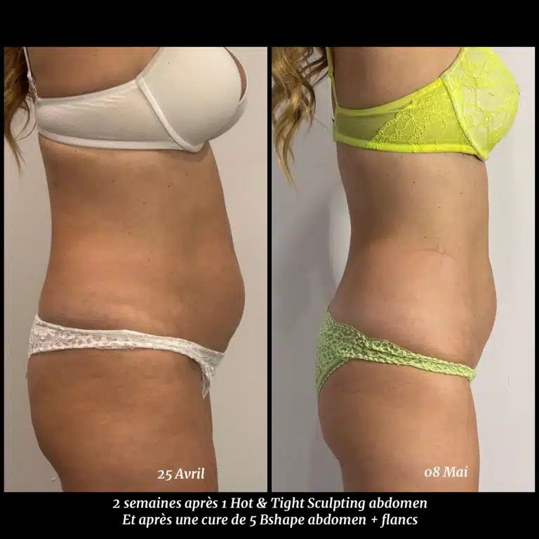 355131858_816258196318466_7163894952982612794_n