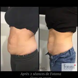 Hot & Tight Sculpting