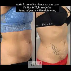 Hot & Tight Sculpting