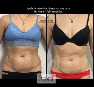 Hot & Tight Sculpting