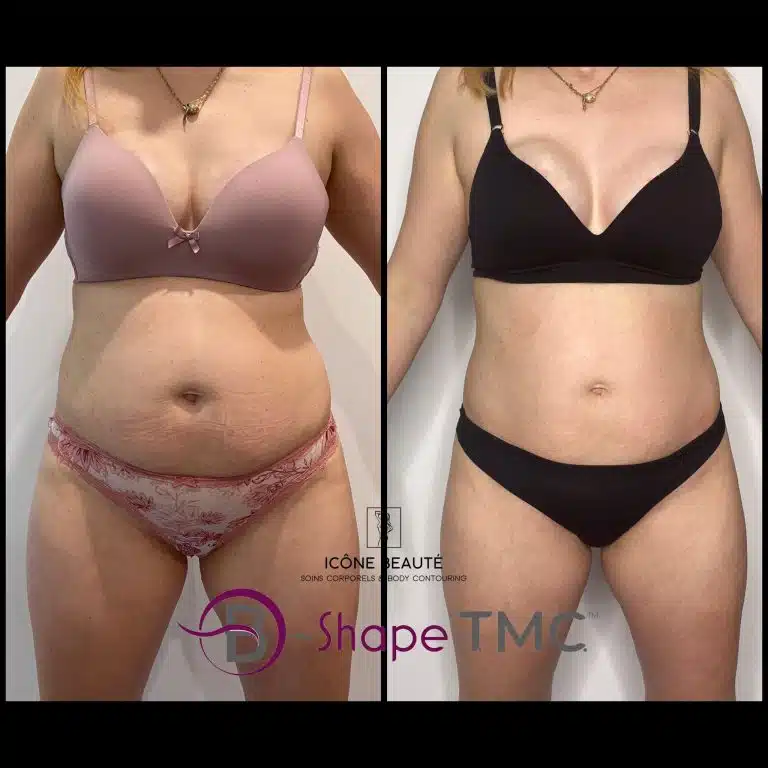 356987615_3290846527883815_3754146101065796681_n