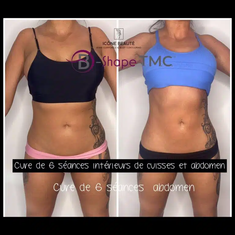 6 séances 60 minutes