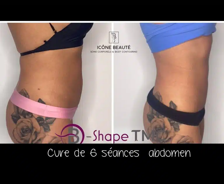 6 séances 60 minutes