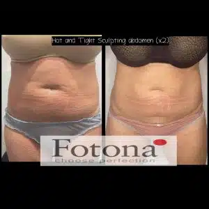 Hot & Tight Sculpting