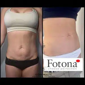 Cure Hot & Tight Sculpting