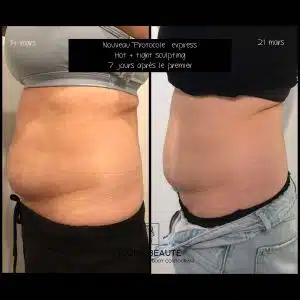 bdafc17a-fc8c-4223-8951-6f2ab602d94f