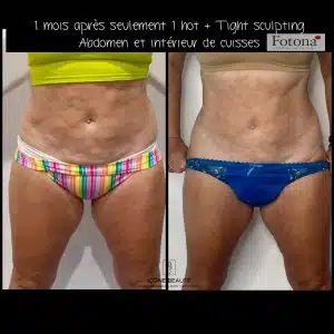 Hot & Tight Sculpting